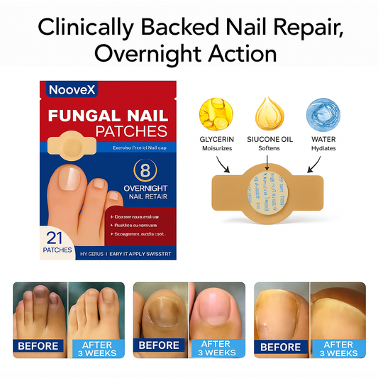 NooveX® Fungal Nail Renuwal Patches