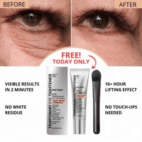 Instant Eye Tightening Cream [Free Today]