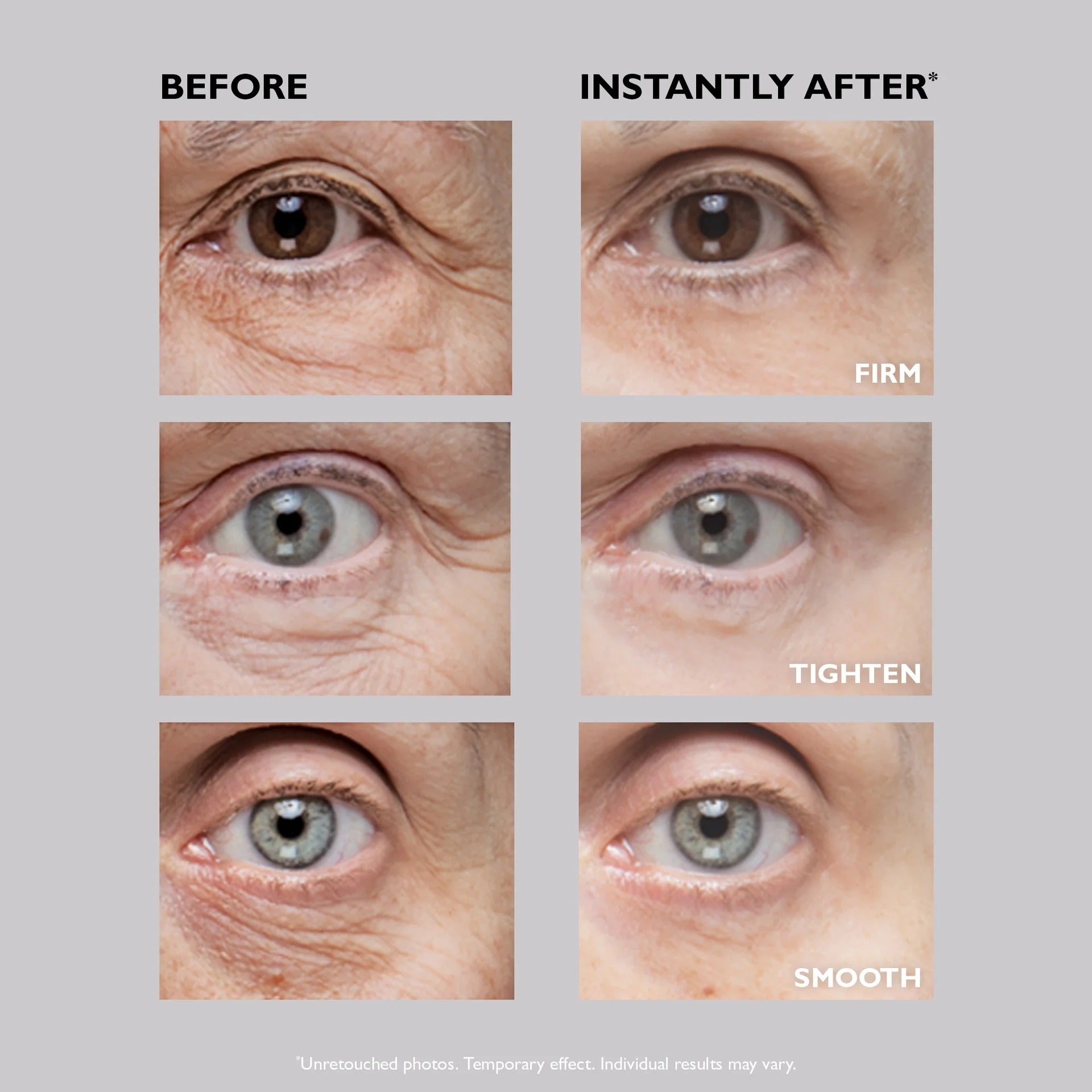 Instant Eye Tightening Cream [Free Today]