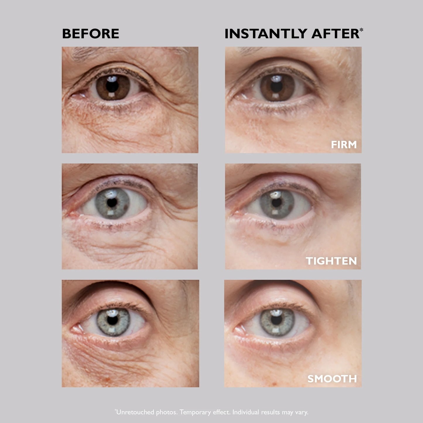 Instant Eye Tightening Cream [Free Today]