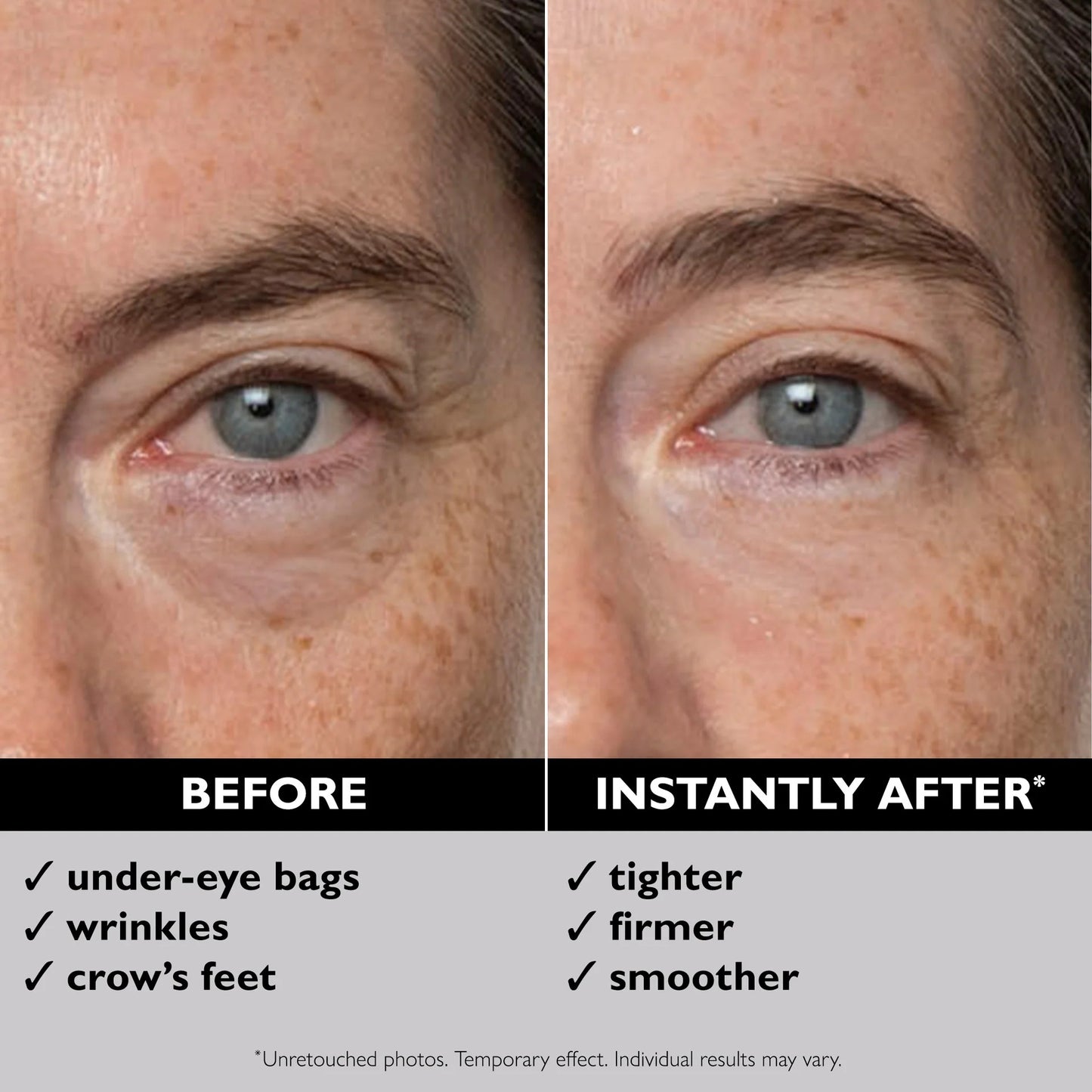 Instant Eye Tightening Cream [Free Today]