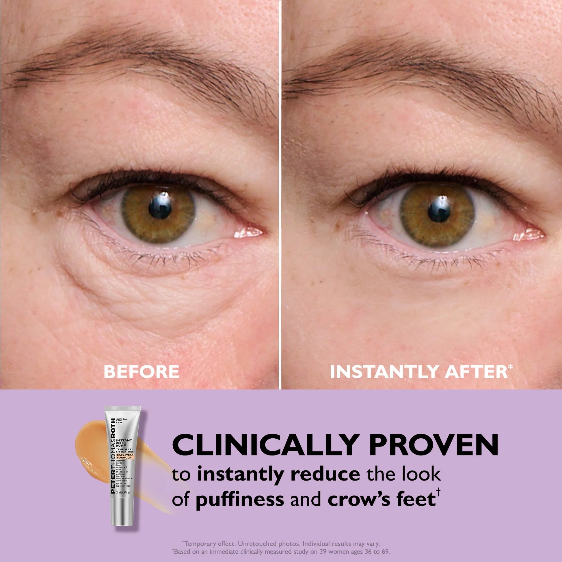 Instant Eye Tightening Cream [Free Today]